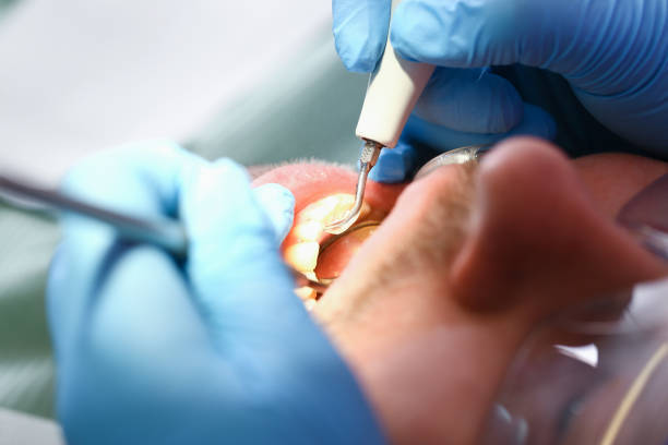Best Same-Day Emergency Dentist in Franklin Rk, PA