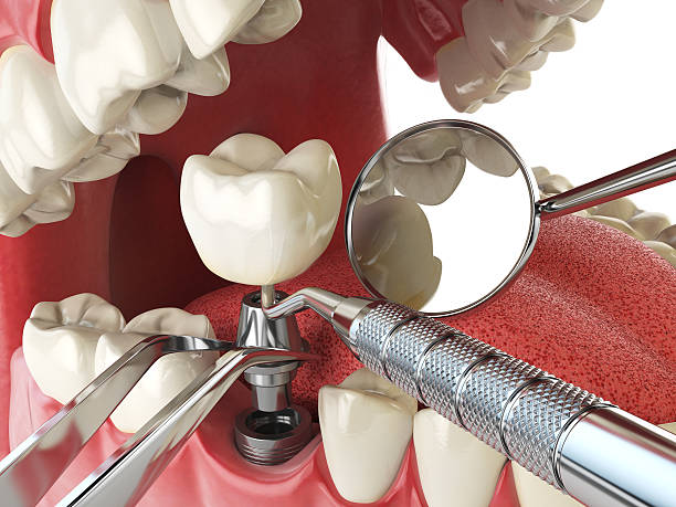 Best Emergency Treatment for Toothache in Franklin Rk, PA